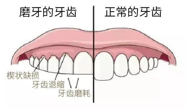 睡觉为什么会磨牙？我控制不了我自己啊！